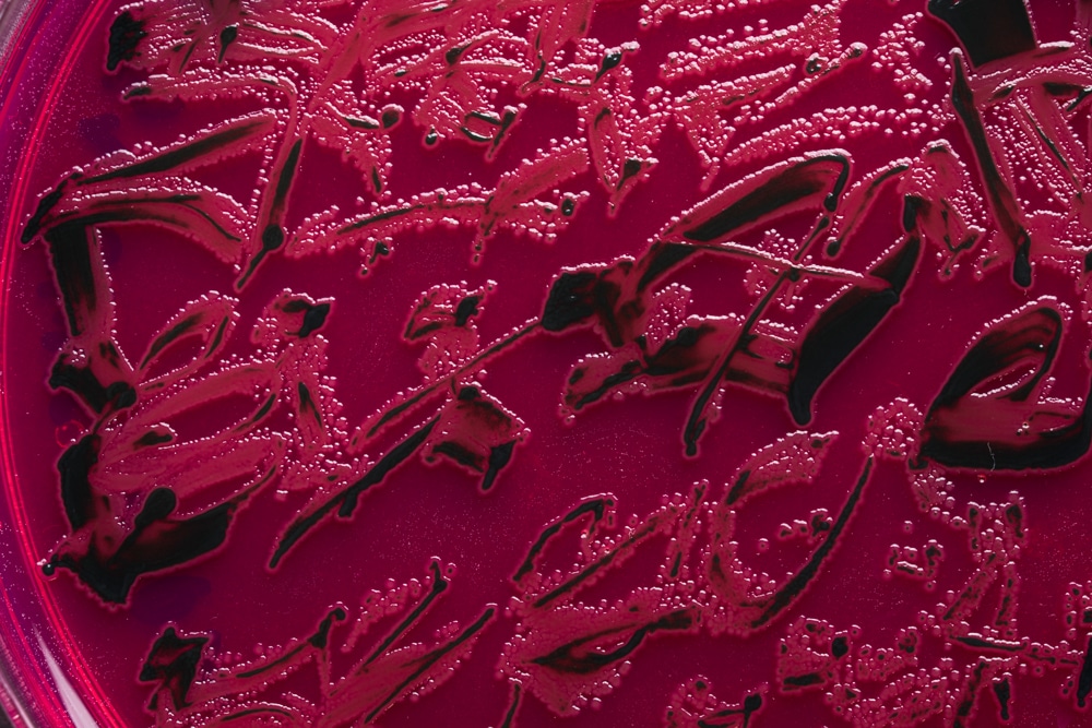 A close-up view of the writing created by Said Dokins for the Bio Recrituras project. The writing is made with living organisms growing on a cultivate medium.