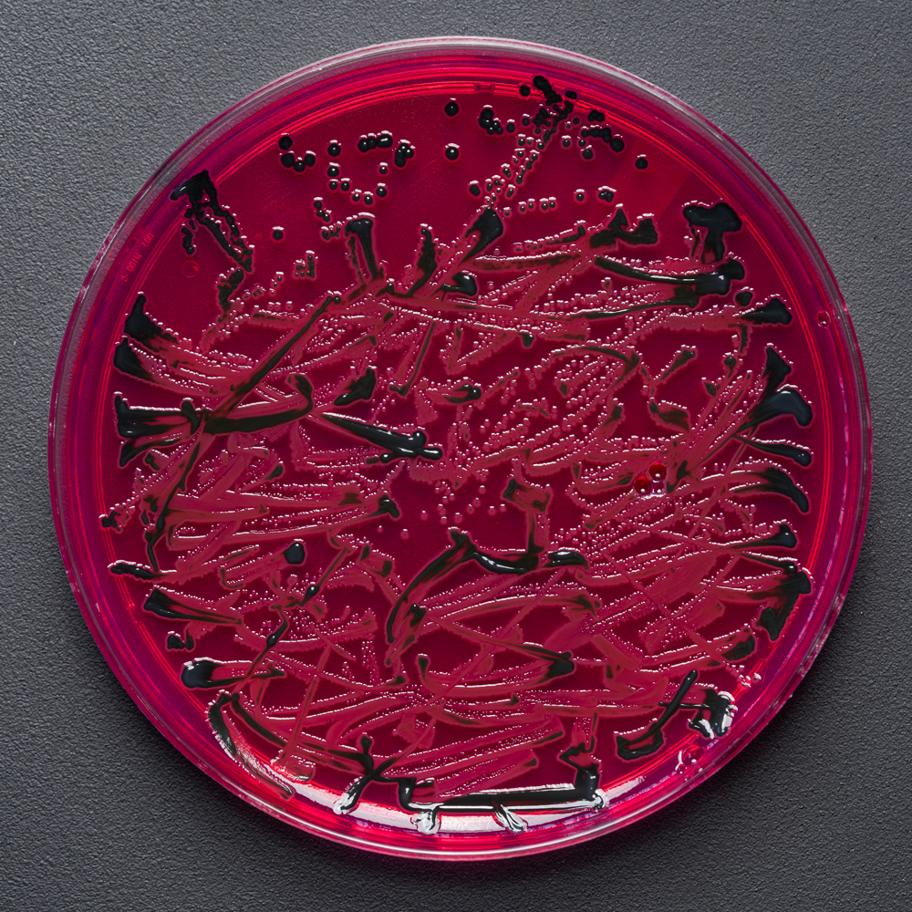 A close-up view of the writing created by Said Dokins for the Bio Recrituras project. The writing is made with living organisms growing on a cultivate medium.